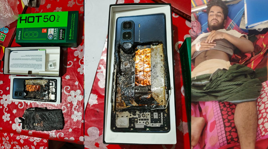 ইনফিনিক্স মোবাইল বিস্ফোরণ, অগ্নিদগ্ধ হয়ে যুবক হাসপাতালে ভর্তি