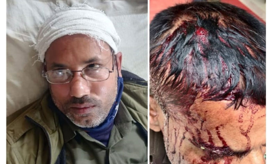 ঘাটাইলে বনের জমি উদ্ধারের সময় মাইকিং করে কর্মকর্তা কর্মচারীদের আটক করে মারধর 