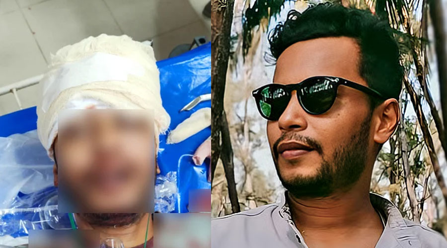 কক্সবাজার বিমান ঘাঁটিতে অতর্কিত হামলা, গুলিতে তরুণ নিহত