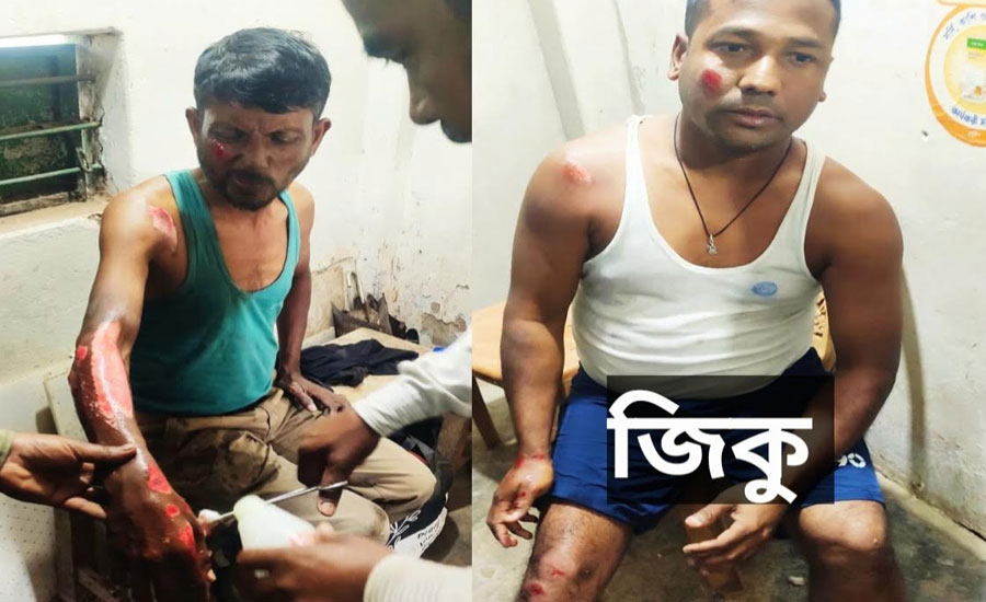 রাজস্থলীতে মোটরসাইকেল নিয়ন্ত্রণ হারিয়ে দুইজন গুরুতর আহত
