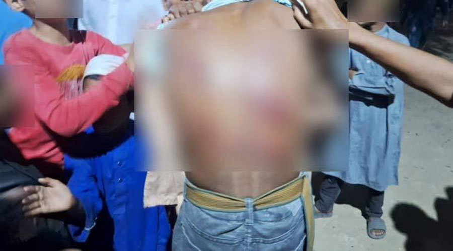 চুরির অপবাদে এতিম শিশুকে খুঁটিতে বেঁধে নির্যাতন