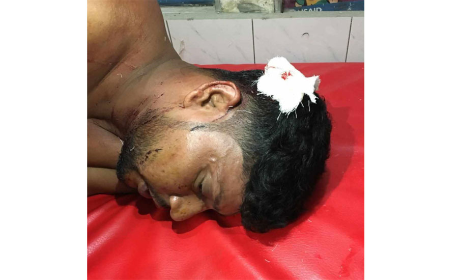 নাটোরে আইনজীবীর বাড়িতে দুর্ধর্ষ ডাকাতি-৩জন আহত 