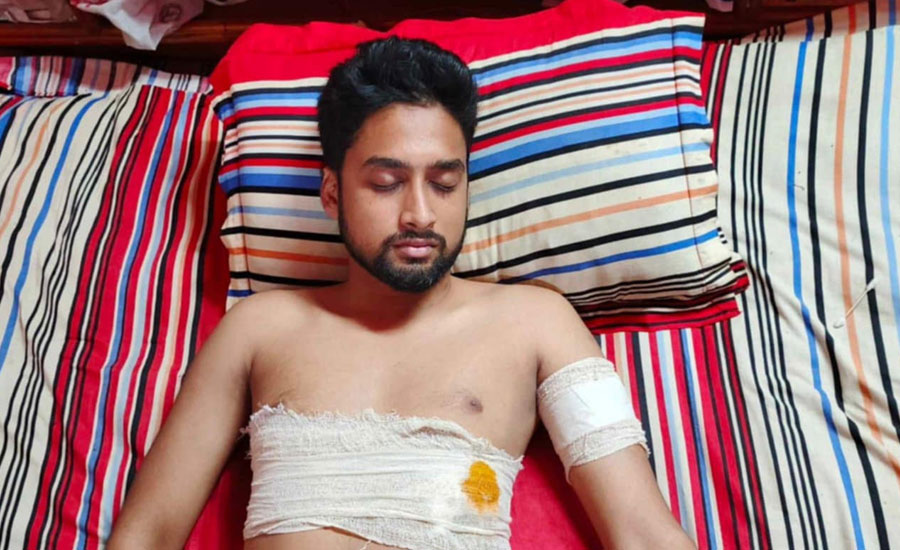 মাদক ব্যবসায় বাঁধা দেওয়ায় কলেজ শিক্ষার্থীকে কুপিয়ে আহত
