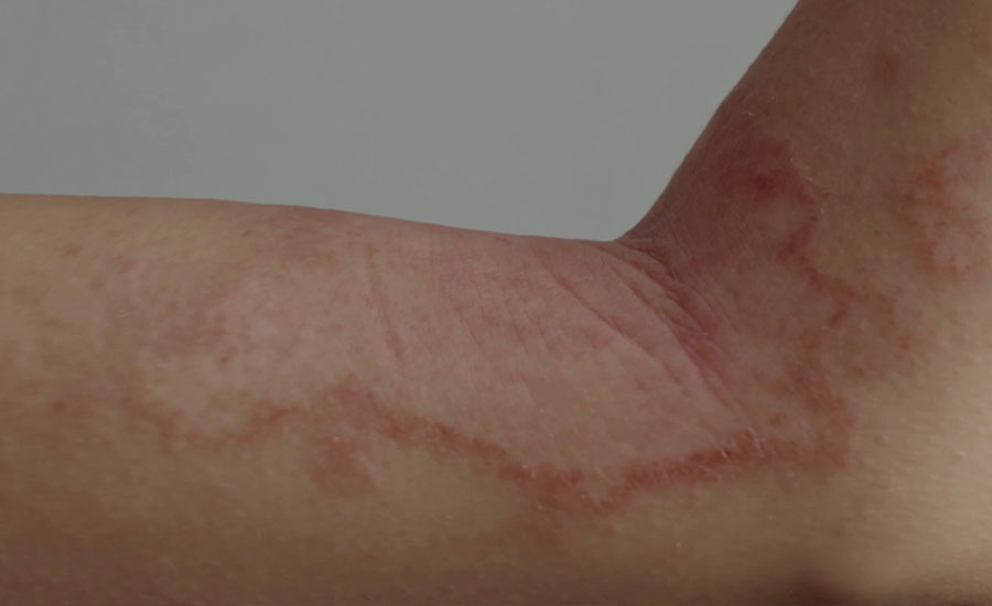 দেশে নতুন ছোঁয়াচে ‘মহামারি’, প্রাদুর্ভাব বাড়ছে