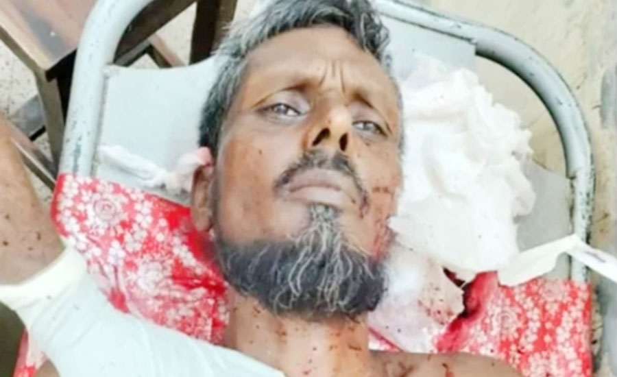 যশোরের জমি বিরোধ বড় ভাইয়ের হাতে ছোট ভাই ছুরির আঘাত 