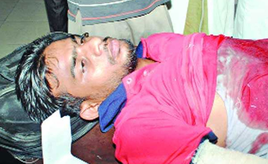 শিবির করায় বিচ্ছিন্ন করা হয় শিক্ষার্থীর পা, সেই দিনের লোমহর্ষক ভয়াবহ বর্ণনা দিলেন শিক্ষার্থী