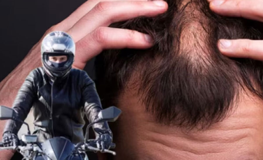 হেলমেট পরার কারণে চুল ঝরছে? জেনে নিন সমাধান
