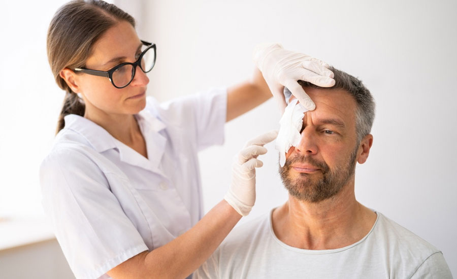 আগুনে পোড়া রোগীর চোখের যত্নে করণীয়