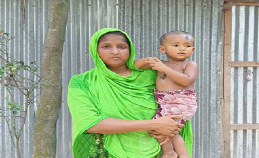 পায়ুপথ নেই ২০ মাস বয়সী শিশুর, বাঁচাতে মায়ের আকুতি