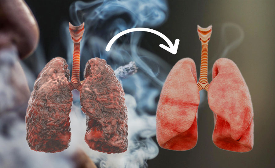 অতিরিক্ত ধূমপানে ফুসফুস ক্ষতিগ্রস্ত?  উপকার মিলবে যে ৮ খাবারে