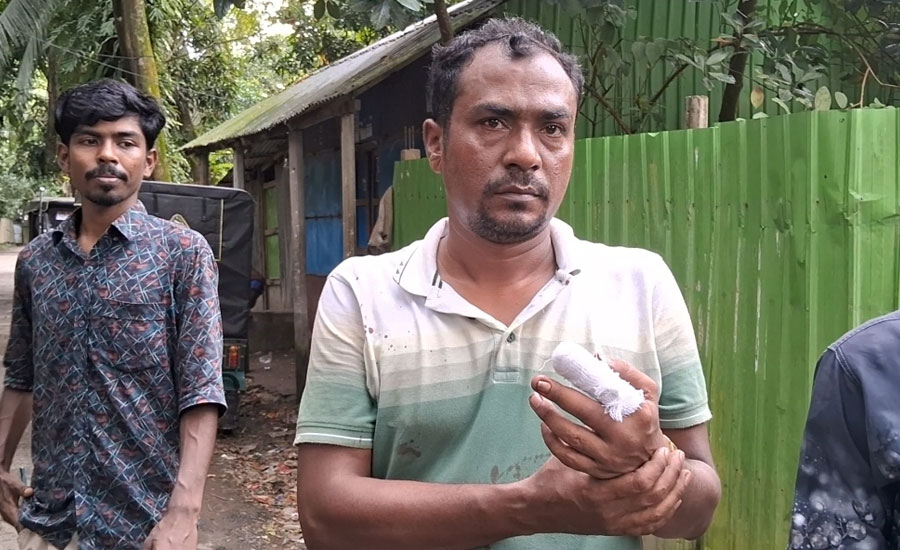 ফেনীর দাগনভুঁইয়ায় প্রবাসীর ওপর সন্ত্রাসী হামলা, ব্যবসায়ীও আহত