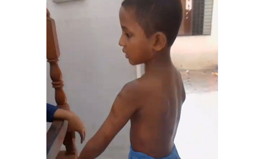 সোনারগাঁয়ে মাদ্রাসা ছাত্রকে বেত্রাঘাতে নির্যাতনের অভিযোগ শিক্ষকের বিরুদ্ধে