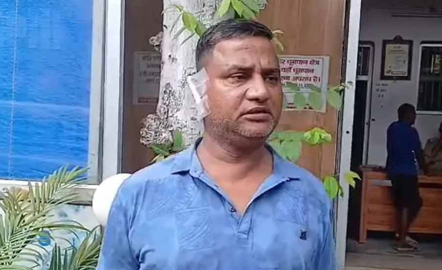 দাম্পত্য কলহের জেরে স্বামীর কান কামড়ে ছিঁড়ে নিলেন স্ত্রী