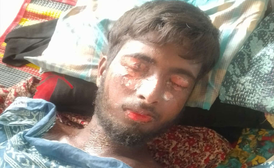 বাঁচতে চায় রাব্বি, প্রয়োজন অর্থ