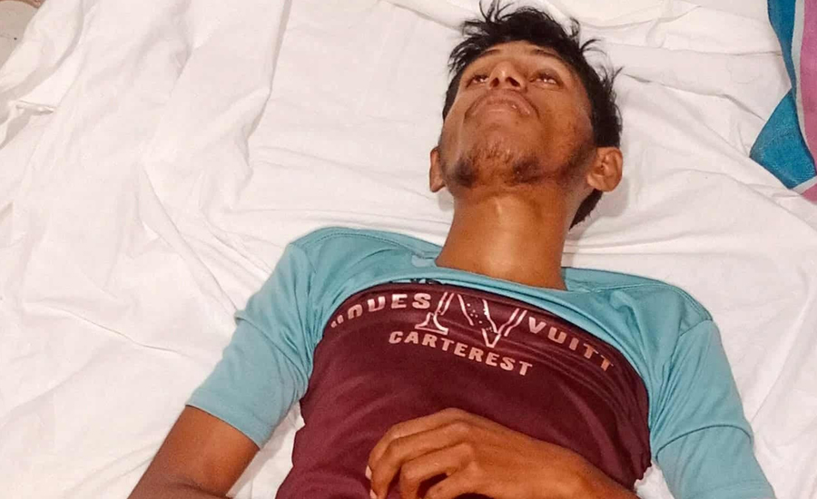 যশোরে ইজিবাইক ছিনতাই চালককে স্প্রে করে অচেতন করার অভিযোগ 