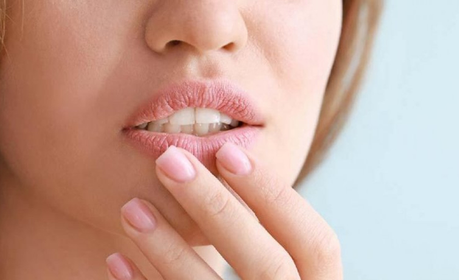 শীত পড়তেই ফাটতে শুরু করেছে ঠোঁট? কী করলে মিটবে সমস্যা?