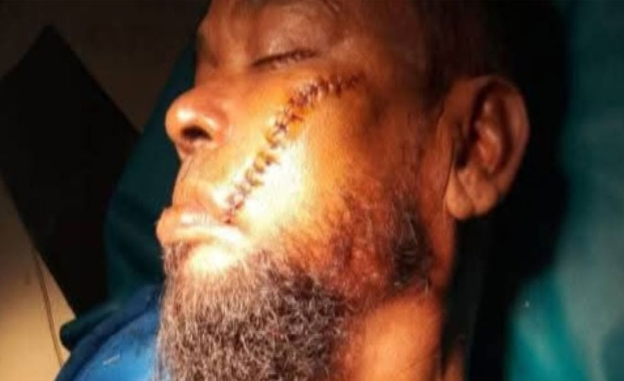 তাড়াশে গৃহকর্তাকে কুপিয়ে জখম করে গরুলুট