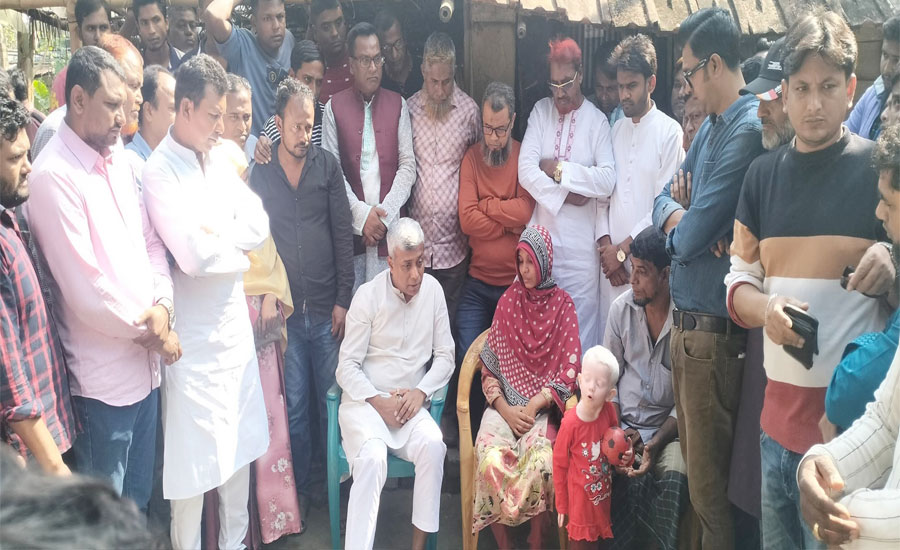 অনিন্দ্য ইসলাম অমিতের মানবিক সহায়তা অসহায় শিশু আফিয়ার পাশে 