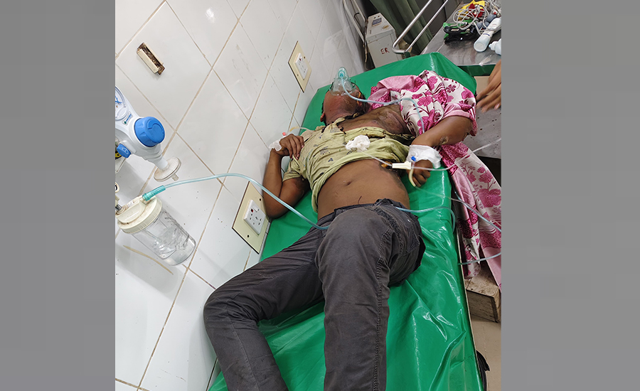 বৈদ্যুতিক শর্ট সার্কিটে গুরুতর আহত কিশোর