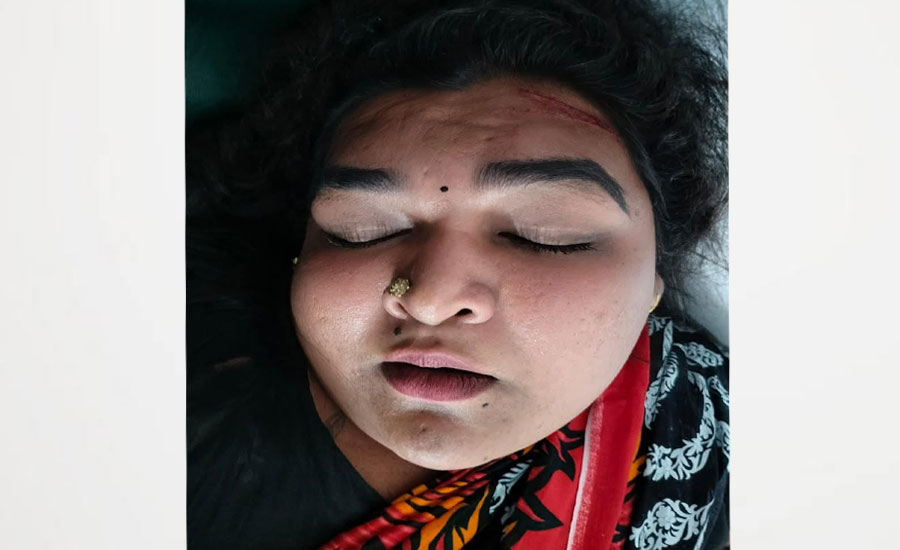 যশোরে হিজড়ার ওপর ব্লেড হামলা হাসপাতালে ভর্তি 