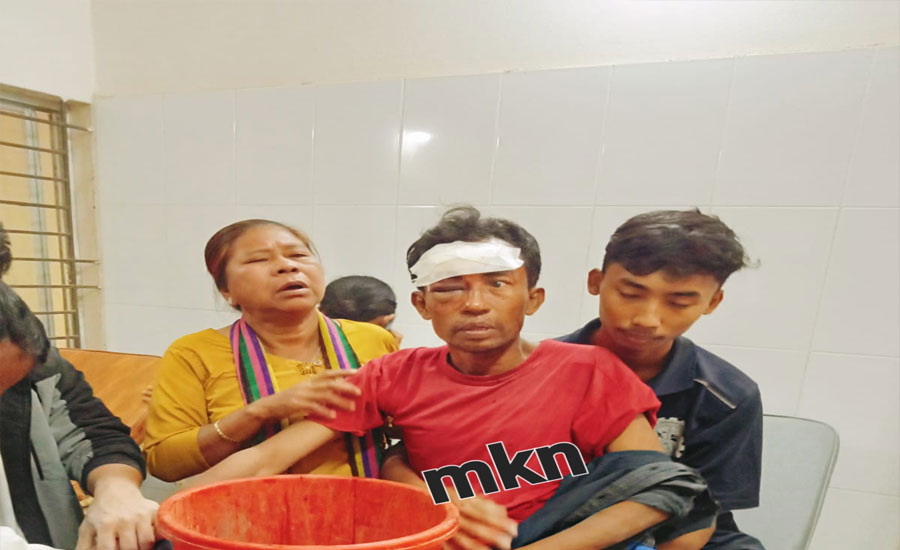 রাজস্থলীতে মোটরসাইকেল মুখোমুখি সংঘর্ষে আহত তিন