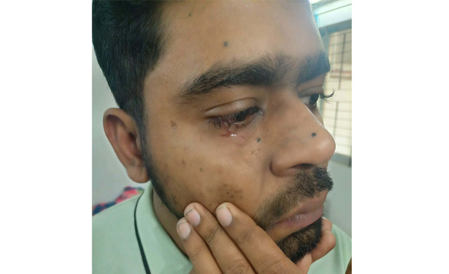 জাতীয় বিশ্ববিদ্যালয়ে ফি বৃদ্ধির প্রতিবাদে শিক্ষার্থীদের আন্দোলন, আইসিটি ভবনে হামলার অভিযোগ