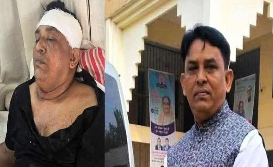 যশোর চৌগাছায় হামলায় আহত সাবেক কাউন্সিলর শাহিনুর রহমানের মৃত্যু