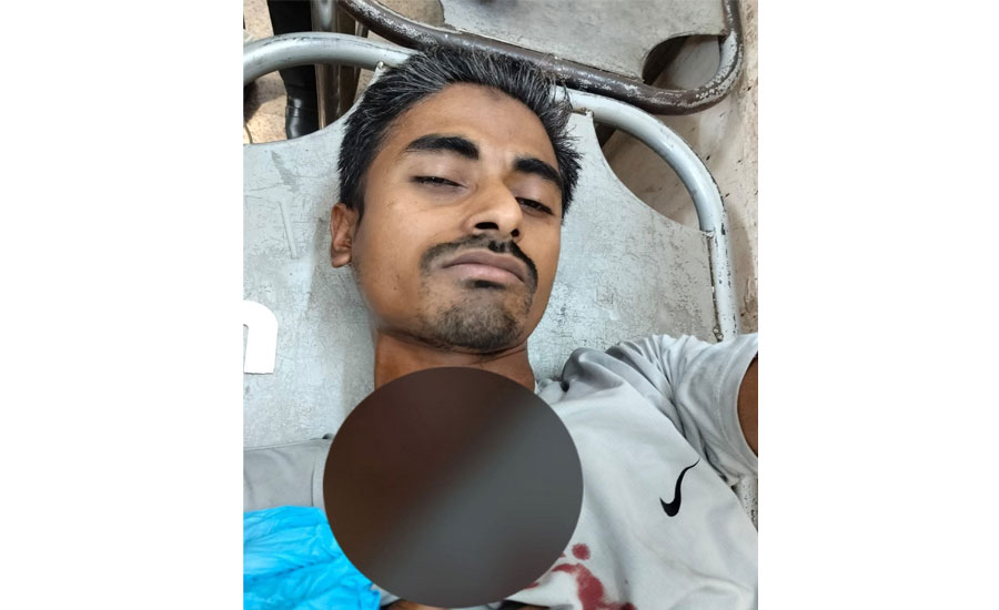 যশোরে সেলাই মেশিন বসানো নিয়ে বিরোধ কাঁচির আঘাতে দর্জি আহত
