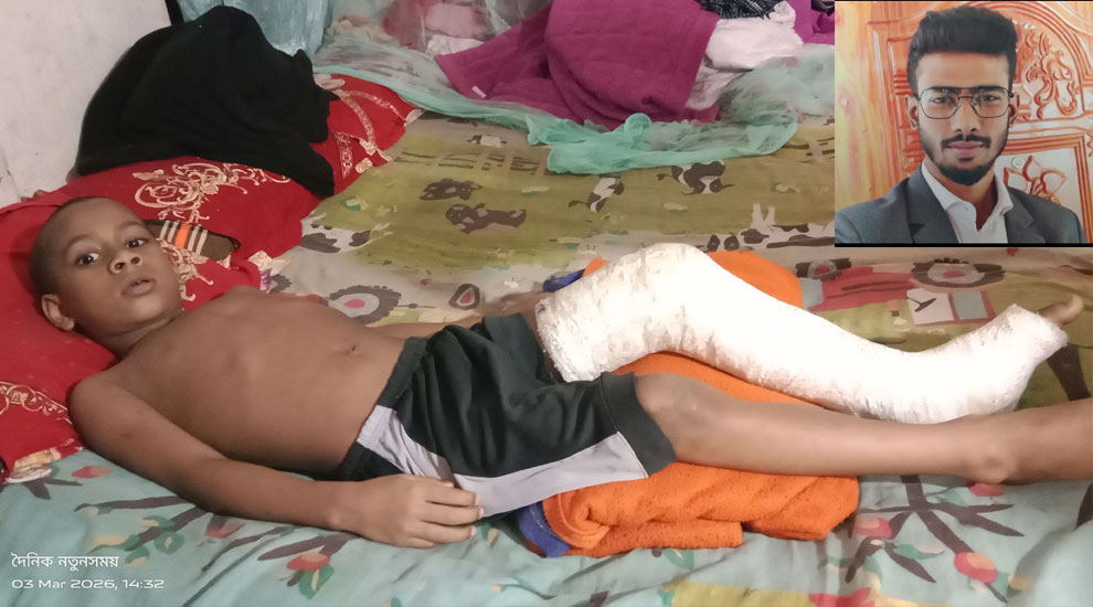 ময়মনসিংহে অধ্যক্ষের হিংস্র থাবায় ভেঙে গেছে শিশুর পা!