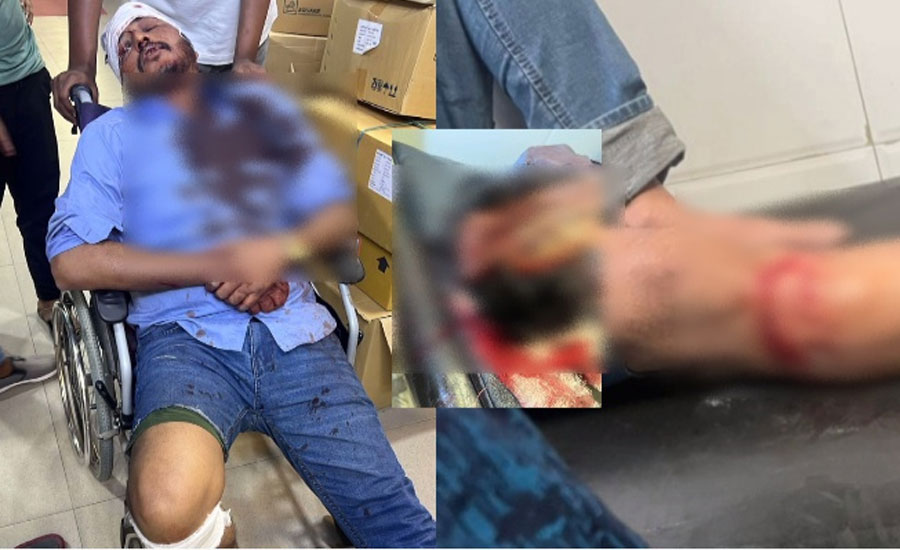 গাজীপুরে কুপিয়ে ব্যবসার ১ লাখ ৮১ হাজার টাকা ছিনতাই , গুরুতর আহত সেলসম্যান