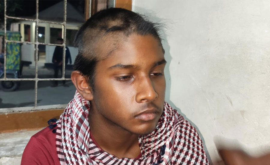 বগুড়ার কিশোরকে নির্যাতন করে মাথার চুল কেটে দেওয়ার অভিযোগ