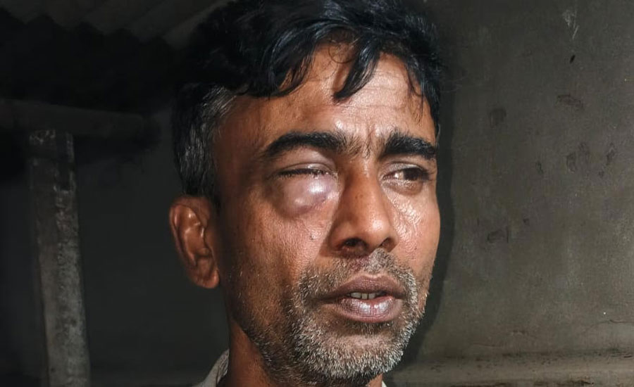 ‎খাবার বিল বেশি না করায় হোটেল কর্মচারীকে পিটিয়ে জখম করলো মালিক