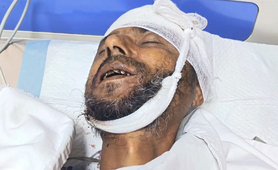 মাধবপুরে জমিজমা নিয়ে বিরোধ সংঘর্ষে বৃদ্ধ নিহত,আহত ৩০