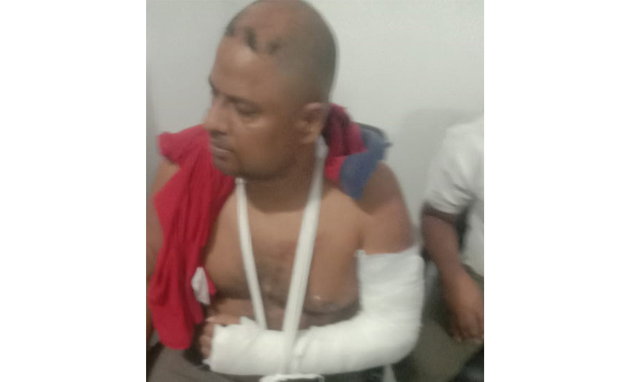 সোনারগাঁয়ে সরকারি চাকুরিজীবীর উপরে সন্ত্রাসী হামলা, আহত একাধিক 