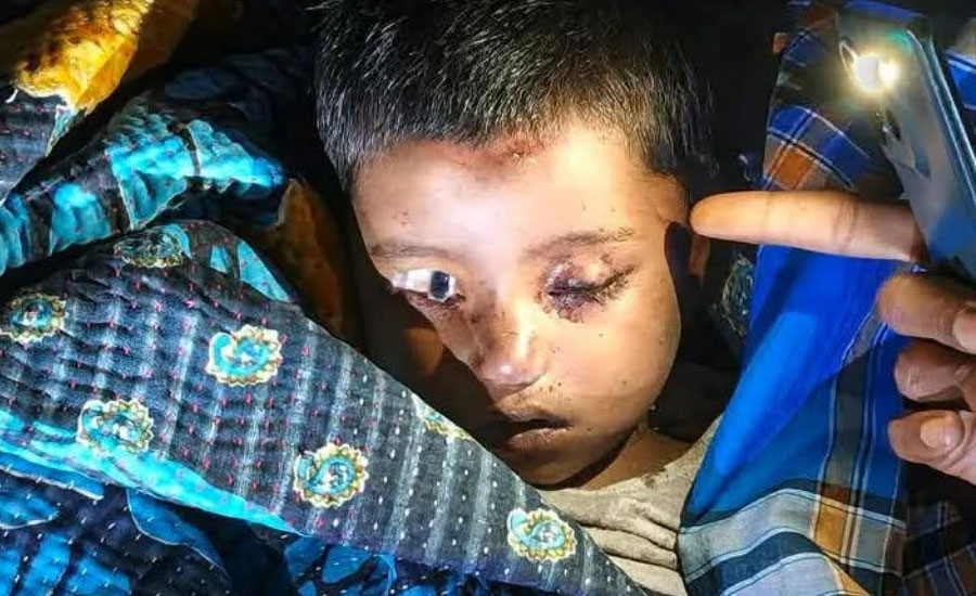 নিখোঁজের ১২ ঘণ্টা পর শিশুর মরদেহ উদ্ধার, চোখে নৃশংস আঘাত