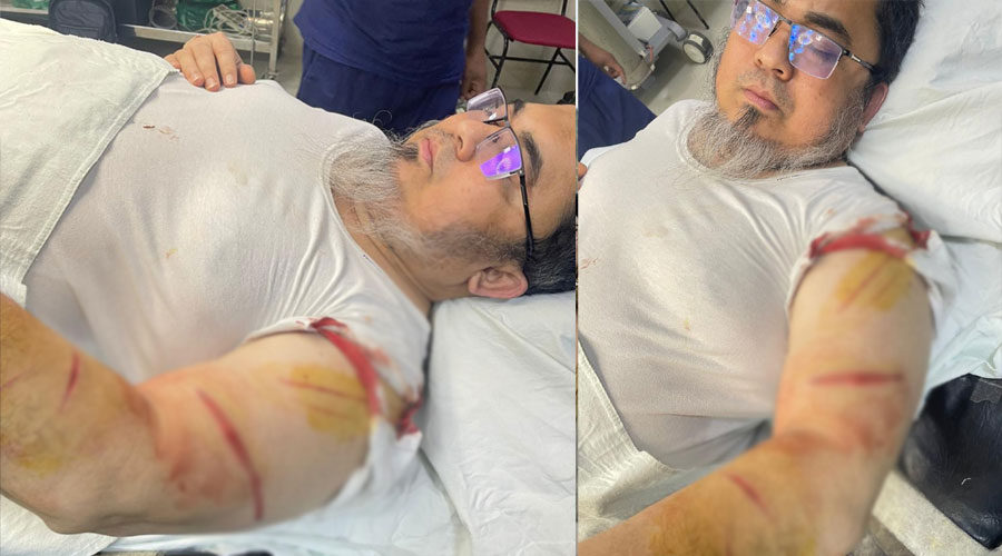 রাজধানীতে চিকিৎসককে কুপিয়ে জখম