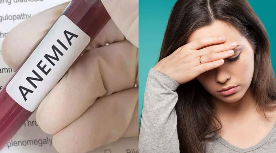 অ্যানিমিয়া আক্রান্তদের নিয়ে নতুন গবেষণায় বেরিয়ে এলো চাঞ্চল্যকর তথ্য