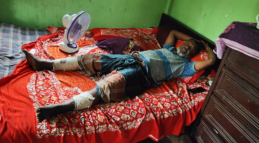 সোনারগাঁয়ে স্বেচ্ছাসেবক দলের নেতার দুই পা ভেঙ্গে দিয়েছে সন্ত্রাসীরা