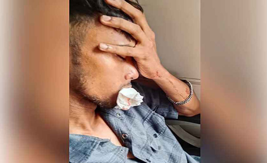 চলন্ত ট্রেনে পাথর নিক্ষেপ, ফাটলো পর্যটকের ঠোঁট