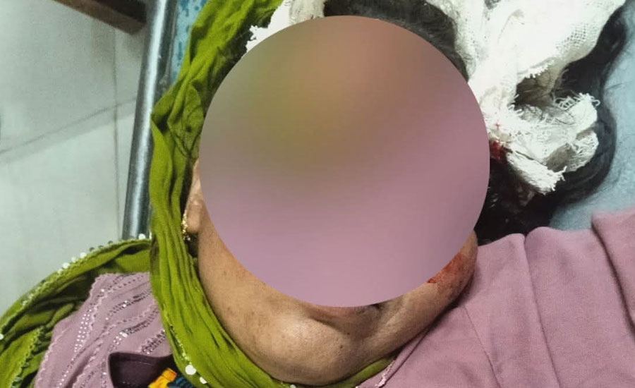 যশোর শার্শায় রাস্তা পার হতে গিয়ে মোটরসাইকেলের ধাক্কায় নারী গুরুতর আহত