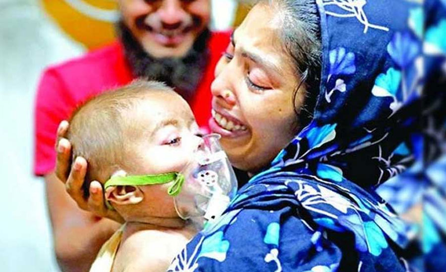 হামের উপসর্গ নিয়ে এবার একদিনে ১২ শিশুর মৃত্যু
