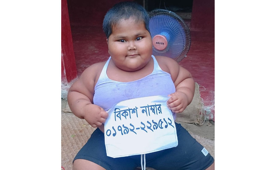 পত্নীতলায় বাঁচতে চায় অস্বাভাবিক মোটা হওয়া শিশু আরাফাত