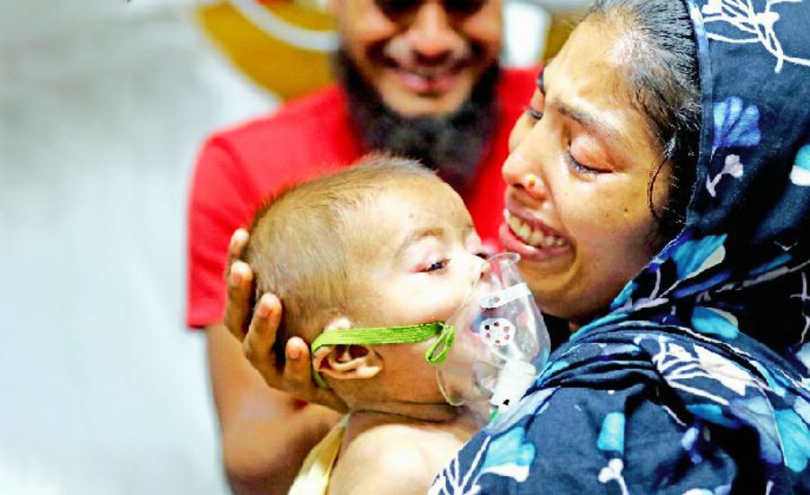 হাম ও হামের উপসর্গ নিয়ে ২৪ ঘণ্টায় মৃত্যু ৯