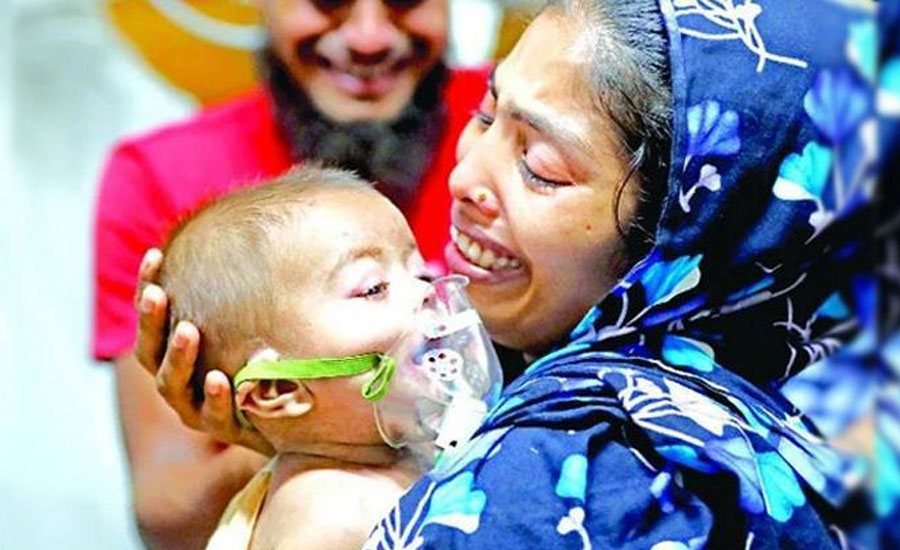 হাম ও উপসর্গে আরও ৮ শিশুর মৃত্যু