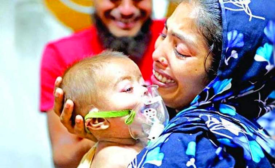 হামের উপসর্গে আরও ৩ শিশুর মৃত্যু, মোট মৃত্যু ৫৮৮