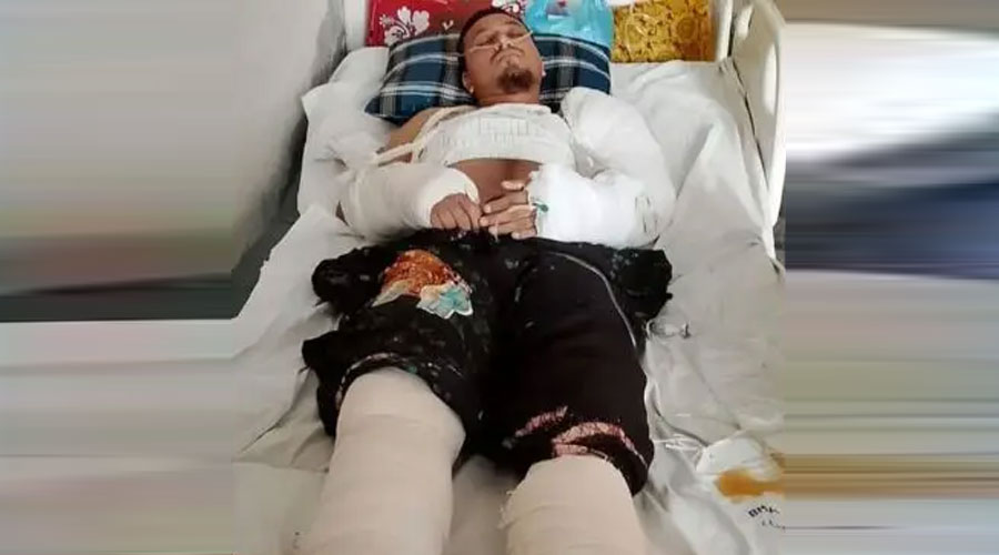 যুবককে ৫ তলা থেকে ফেলে দেন স্ত্রী-শ্যালক, ভেঙেছে হাত-পা ও কোমরের হাড়