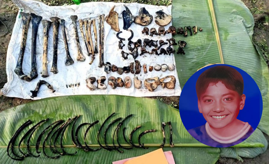 এক বস্তা হাড়গোড়, একটি ডিএনএ পরীক্ষা, একটি ফোনালাপে এক খুনের রহস্যভেদ