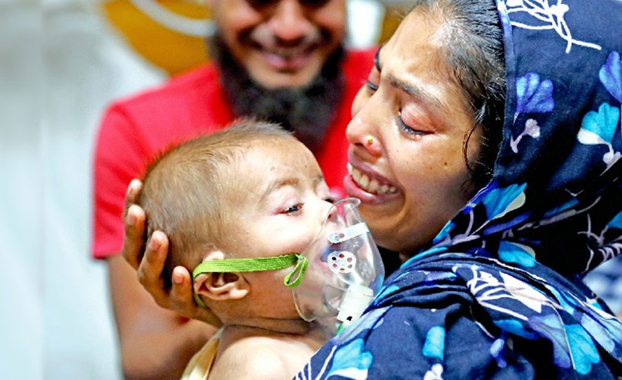 হামের উপসর্গে আরও ৩ শিশুর মৃত্যু, মোট ৭৪১