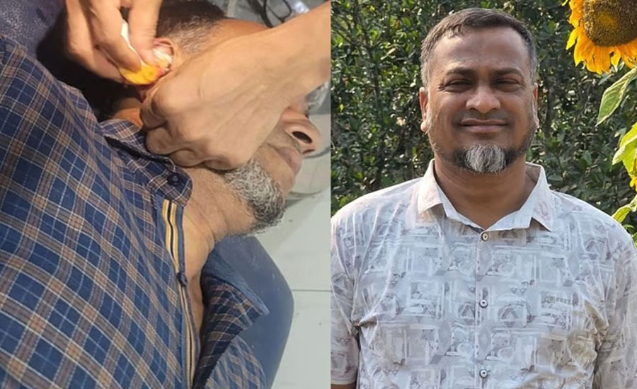 নরসিংদীতে ব্যবসায়ীর কান কামড়ে বিএনপি নেতা বললেন, এলাকা ছাড়