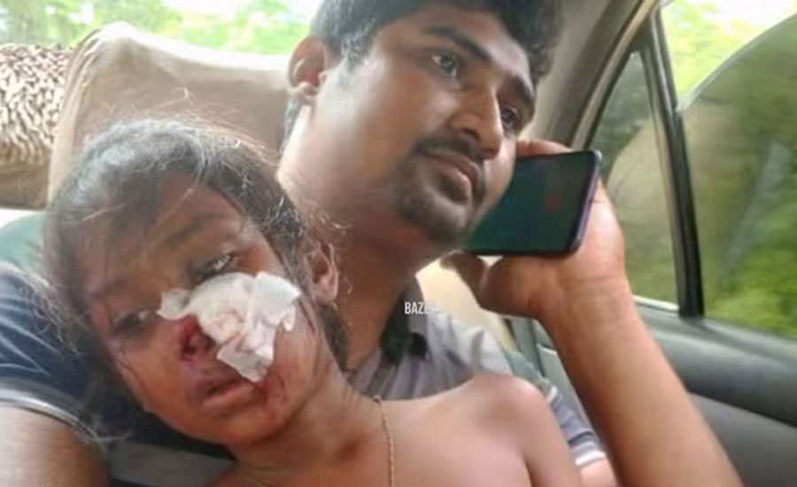 পাইকগাছায় শ্রেনী কক্ষের ফ্যান ছিঁড়ে পড়ে শিক্ষার্থী আহত 